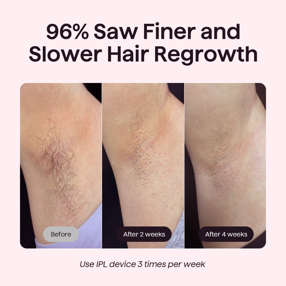Bare It Without Roller - Image 4